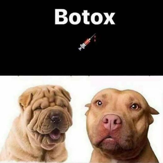 Botox 3